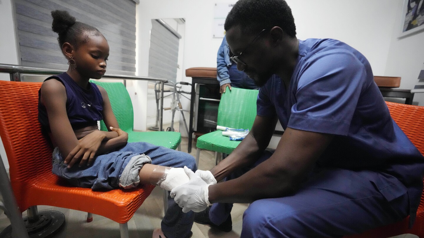 Nigerian group provides hundreds of prosthetic limbs to amputee children thanks to crowdfunding | AP News