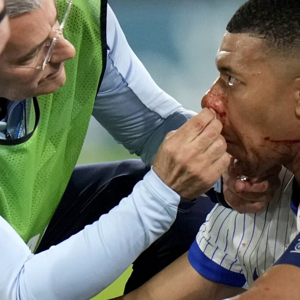 Mbappé suffers facial injury in France’s 1-0 win against Austria at Euro 2024