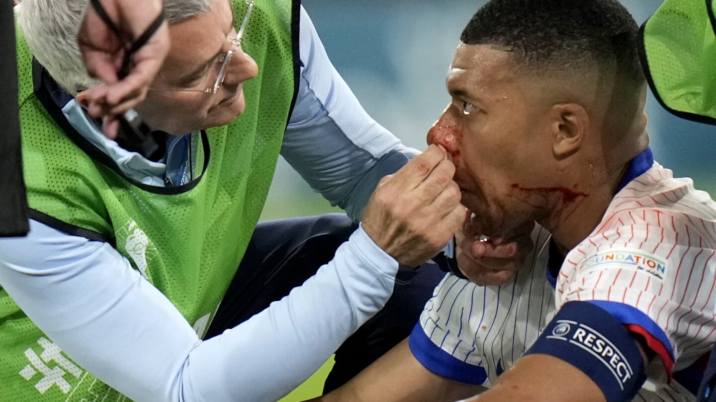 Mbappé suffers facial injury in France’s 1-0 win against Austria at Euro 2024