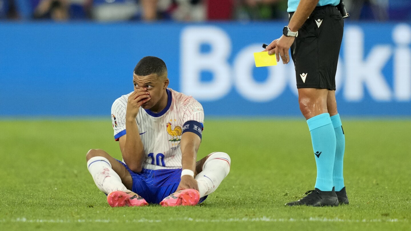 Kylian Mbappé feeling ‘a bit better’ after facial injury, France teammate Saliba says