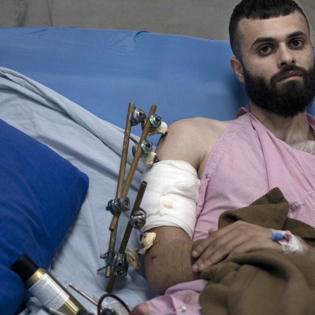 A Palestinian was shot, beaten and tied to an Israeli army jeep. The army says he posed no threat