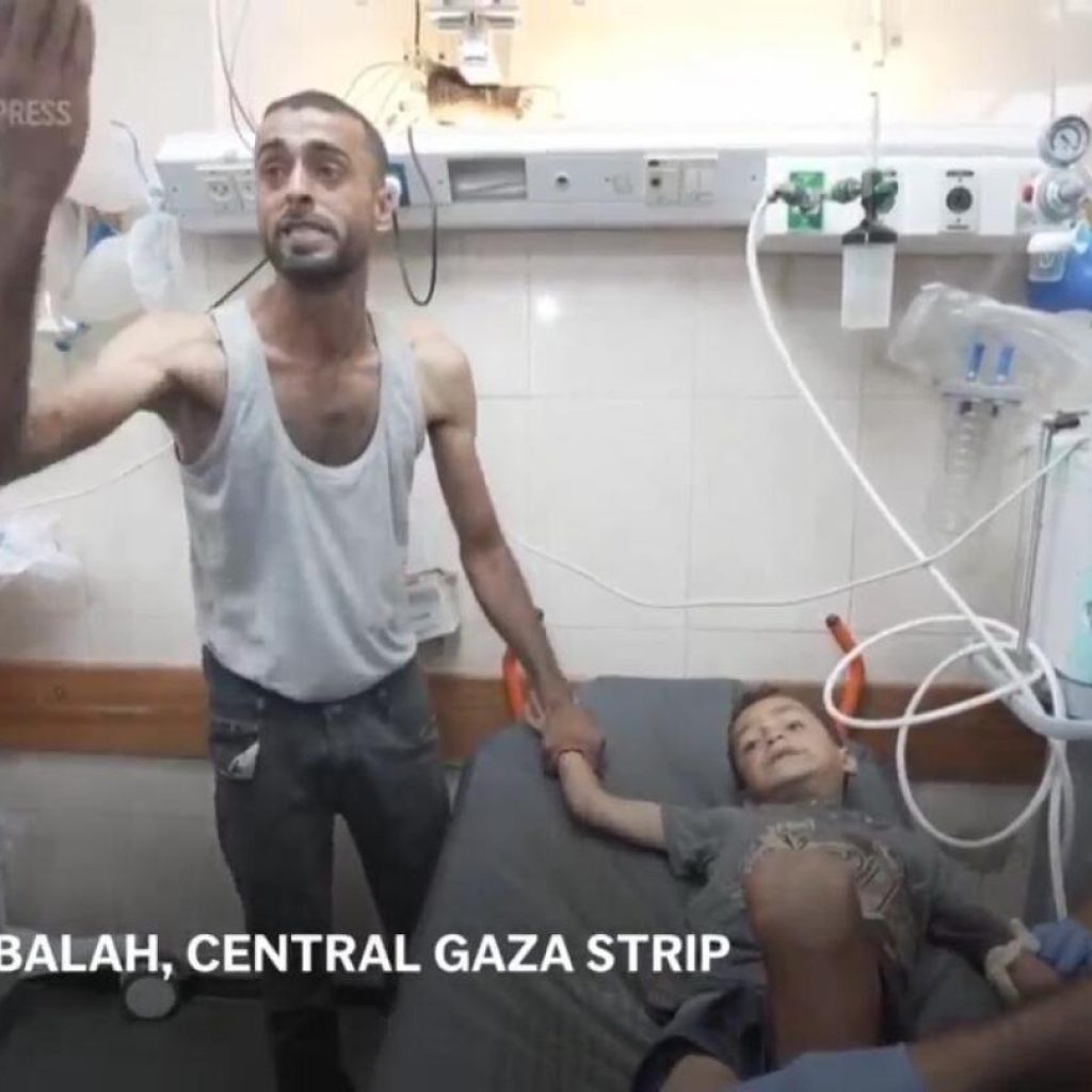 Dead and injured brought to central Gaza hospital after Israeli strikes | AP News