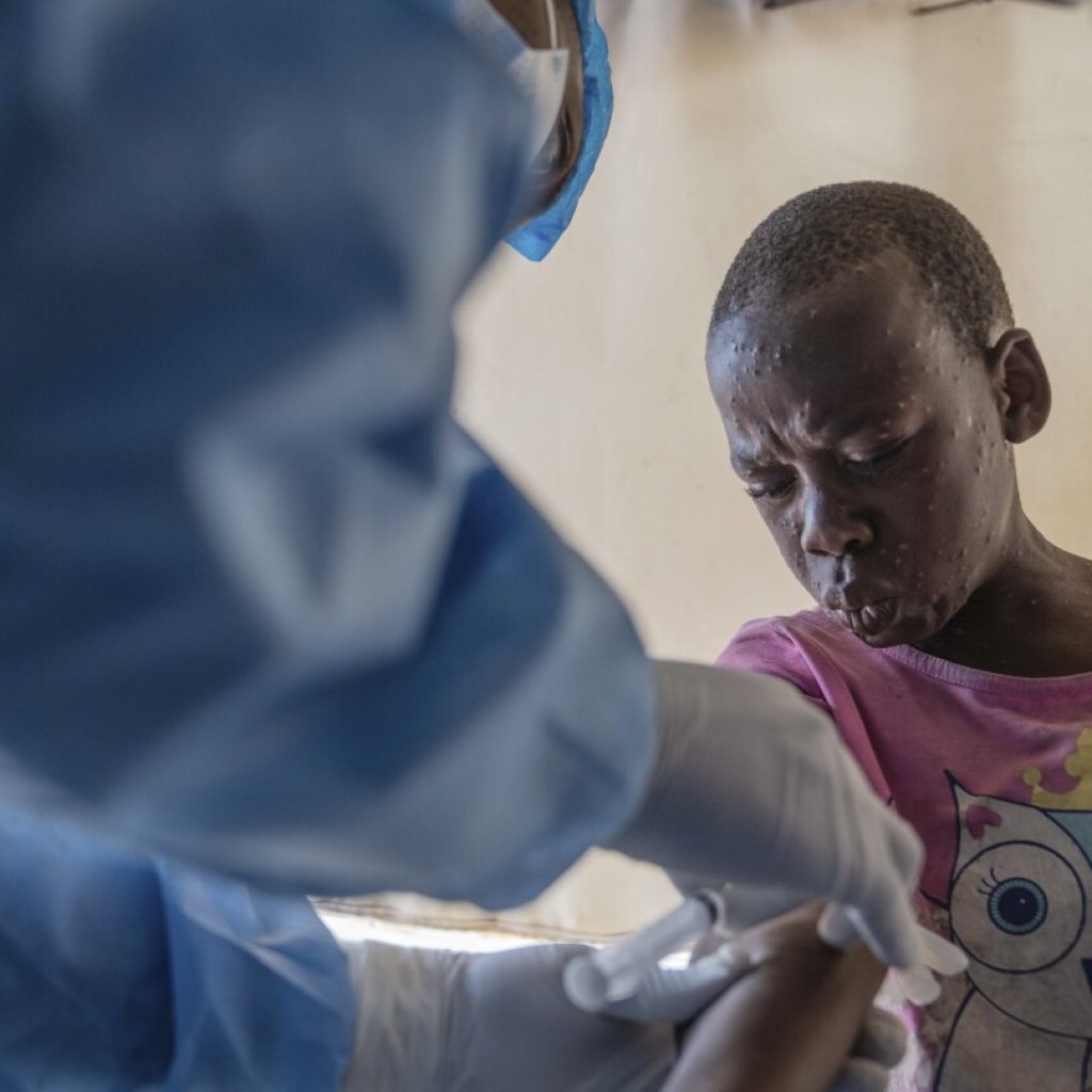 Congo reports more than 1,000 new mpox cases in a week. African authorities ask for vaccines