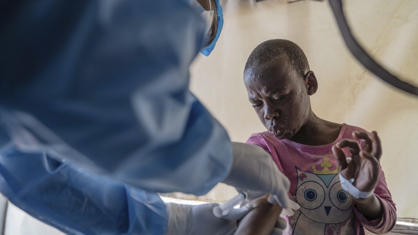 Mpox outbreaks in Africa could be ended in 6 months, WHO chief says